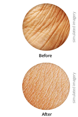 Skin Before and After